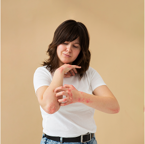 patient suffering from psoriasis